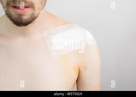 Weiße Kaukasier Männlich mit einem gebrochenen Schlüsselbein/Schlüsselbein/clavicula nach der Operation mit einem Band Aid nach einem Fahrrad crash Stockfoto