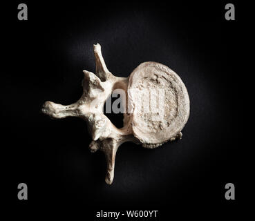 Wirbel aus menschlichen Knochen schließen bis auf schwarzem Hintergrund Stockfoto