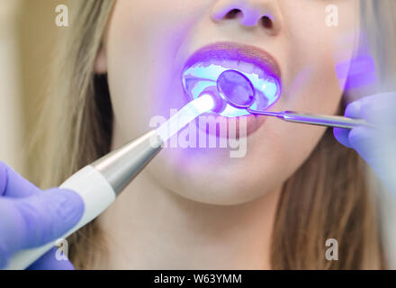 Zahnarzt tun Verfahren mit zahnmedizinischen Härtung mit UV-Licht in der Klinik Stockfoto