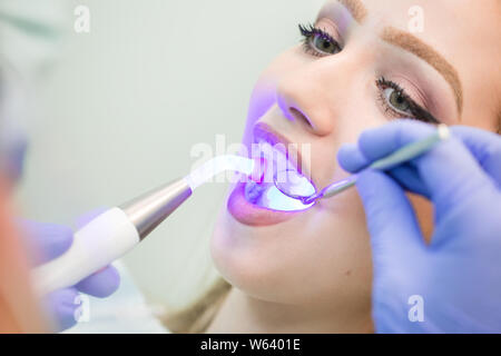 Zahnarzt tun Verfahren mit zahnmedizinischen Härtung mit UV-Licht in der Klinik. Stockfoto