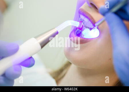 Zahnarzt tun Verfahren mit zahnmedizinischen Härtung mit UV-Licht in der Klinik Stockfoto