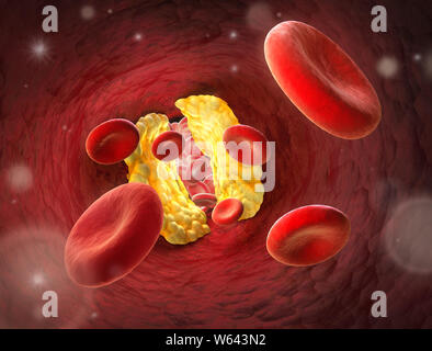 Rote Blutkörperchen - die Verengung in ein Blutgefäß-Erythrozyten 3D-Darstellung Stockfoto