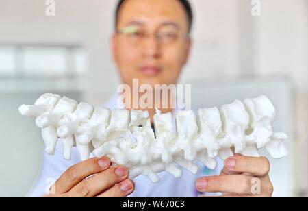 Ein Arzt zeigt eine 3D-gedruckten Modell für Thorax orthopädische Chirurgie auf den ersten Krankenhaus von Qinhuangdao in Qinhuangdao Stadt eingesetzt, der ostchinesischen Provinz Hebei provin Stockfoto