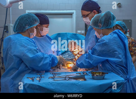 Neue Leben, Baby per Kaiserschnitt im Op geboren zu werden. Stockfoto