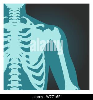 X-ray Schuß von Schulter, menschliche Körper Knochen, Radiographie, Brustkorb, Brust und Arm, Vector Illustration. Stock Vektor