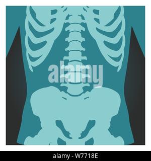 X-ray Schuß von Wirbelsäule, Becken und Brustkorb, menschliche Körper Knochen, Radiographie, Vector Illustration. Stock Vektor