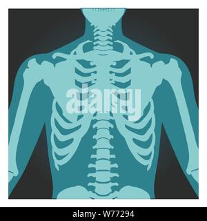X-ray Schuß von Schulter, menschliche Körper Knochen, Radiographie, Brustkorb, Brust und Arm, Vector Illustration. Stock Vektor