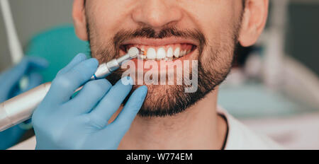 Schuss Teil des Kopfes, gesunde weiße männliche Lächeln mit zahnärztliche Bohrer close-up. Behandlung Stockfoto
