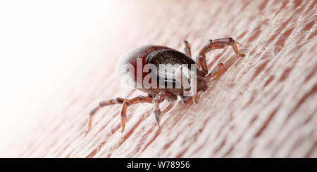 3D-gerenderte Abbildung: die Zecke in die menschliche Haut beißen Stockfoto