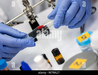 Wissenschaftler halten Polizei Wattestäbchen Mikroskop Unterstützung mit Blut Spuren, konzeptionelle Bild Stockfoto