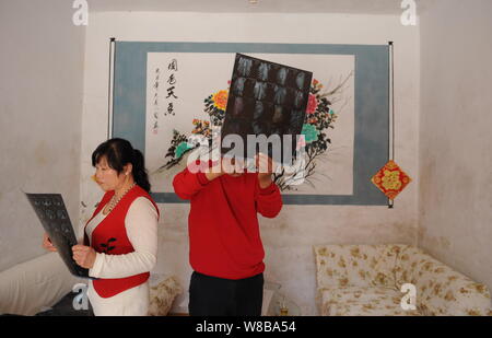 Chinesen Liu Yongwei, entdeckte seine rechte Niere gegangen war fehlt, nachdem er eine Brust Chirurgie in Xuzhou Medical School Krankenhaus zuletzt empfangenen Jun Stockfoto