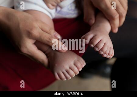 Die Füße der drei Monate alten Baby boy Hong Hong, die hat 15 Finger, 16 Zehen gezeigt werden durch seine polydactyl Mutter, die hat 12 Finger, 12 Zehen an Stockfoto