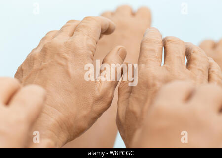 Die Ausstellung Mensch und Silikon Frauen Prothese Hände, Medizin rosa Implantate für Person Stockfoto