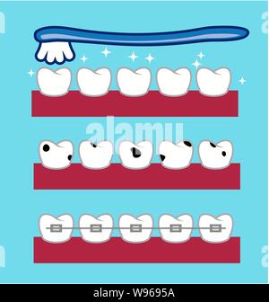 Vektor Zahnbürste über gesund und glänzend Zähne. zahnmedizinische Zahn Karies. kieferorthopädische Zahn Klammer. flat style Icons Stock Vektor