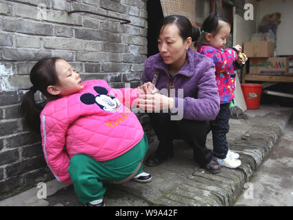 Hu Yunxing (links), ein 4-jähriges Mädchen, dessen Bauch misst 1,06 m im Umfang, außerhalb eines Hauses in Xuzhou Stadt gesehen, Ostchina Shanxi P Stockfoto