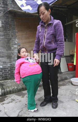 Hu Yunxing (links), ein 4-jähriges Mädchen, dessen Bauch misst 1,06 Meter im Umfang, steht außerhalb eines Hauses mit Hilfe ihrer Mutter, Xue C Stockfoto