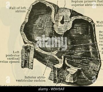 Archiv Bild von Seite 1067 von Cunningham's Lehrbuch der Anatomie (1914). Cunninghams Lehrbuch der Anatomie cunninghamstextb 00 cunn Jahr: 1914 (1034 Die VASCULAE SYSTEM. Die Perforationen schließlich verschmelzen die sekundäre Foramen ovale der atrialen Septum zu bilden. Sobald das Septum primum abgeschlossen ist, ist das primitive Atrium ist in der Ständigen rechts und links Atrien aufgeteilt, von denen jeder kommuniziert über die sekundäre Foramen ovale, mit dem Atrium des linken Teils der atrio-ventrikulären Drossel Truncus arteriosus gegenüberliegenden Seite und mit dem Septum primum verschmilzt mit entspreche Stockfoto