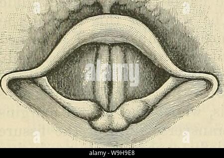 Archiv Bild von Seite 1111 von Cunningham's Lehrbuch der Anatomie (1914). Cunninghams Lehrbuch der Anatomie cunninghamstextb 00 cunn Jahr: 1914 (1078 Die KESPIEATOEY SYSTEM. Bei dieser Prüfung der gewölbten oberen Grenze der epiglottis ist ein auffälliger Objekt, während, dorsale, die Wölbung auf der ventralen Wand der Apsis, gebildet durch die tuberkel Der epiglottis, vielleicht auch eine Funktion des Bildes ist. Die mediane glosso - epiglottic Klappen mit dem epiglottic vallecula auf beiden Seiten von ihm, kann auch im Intervall zwischen den kehldeckel und der Unterseite der Zunge geprüft werden. Die Sha Stockfoto