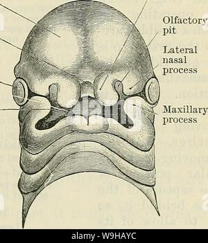 Archiv Bild von Seite 1412 von Cunningham's Lehrbuch der Anatomie (1914). Cunninghams Lehrbuch der Anatomie cunninghamstextb 00 cunn Jahr: 1914 (DAS GESICHT. 1379 (2) durch die canine Fossa, lateral der Vorsprung durch die Wurzel aus der Hunde- Zahn verursacht; oder (3) durch die seitliche Wand des Meatus inferior der Nase. In einem antero-posterior skiagram des Schädels, der Schatten der Kieferhöhle präsentiert eine pyramidenförmige Umrisse, die Basis, die den Boden der Orbit und der abgerundete Apex auf die alveoläre Aussparung des Sinus. Manchmal den Boden der Sinus erstreckt sich medial, unten. Stockfoto