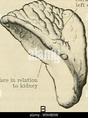 Archiv Bild von Seite 1377 von Cunningham's Lehrbuch der Anatomie (1914). Cunninghams Lehrbuch der Anatomie cunninghamstextb 00 cunn Jahr: 1914 (Fläche im Verhältnis zu Links Crus der Membranfläche in Bezug auf die Nieren Fläche im Verhältnis zur Niere Abb. 1055. A. in der hinteren Oberfläche der rechten Nebennierenhormonen Drüse. B. in der hinteren Oberfläche der Linken nebennierenhormonen Drüse. das Ligamentum latum, auf der Samenstrang, oder sogar die Nebenhoden befestigt. Wie die wichtigsten Drüsen, Zubehör suprarenals sind verstärkt von Cortex und medulla, und erfordern von chromaphil Gremien und Zubehör kortikalen zu unterscheiden. Stockfoto