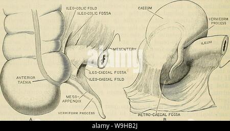 Archiv Bild von Seite 1453 von Cunningham's Lehrbuch der Anatomie (1914). Cunninghams Lehrbuch der Anatomie cunninghamstextb 00 cunn Jahr: 1914 (1420 SUKFACE UND SUEGICAL ANATOMIE. Fossa nach oben schauen. Das ist eine der Situationen, in denen eine interne Hernie manchmal entwickelt, der sac, wie es vergrößert, weiter und weiter bis in die extra-Peritonealen Gewebe auf der hinteren Bauchwand. Sollten Erdrosselung auftreten, die untere Kante der Öffnung müssen nach unten verteilt werden, um die A. mesenterica inferior Vene, die Kurven der anterioren und superior Aspekte noch zu vermeiden Stockfoto