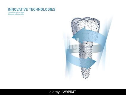 Backenzahn zahnmedizinische 3d-Low Poly geometrische Modell Implantat. Zahnheilkunde Innovation Zukunft Technologie titan Metall Gewinde. Medizinische Wissenschaft polygonalen Stock Vektor