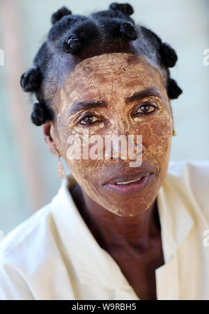 Frau mit Gesichtsmaske in Anakao, Madagaskar. Aufgrund einer politischen Krise in Madagaskar gehört zu den ärmsten Ländern der Welt Stockfoto