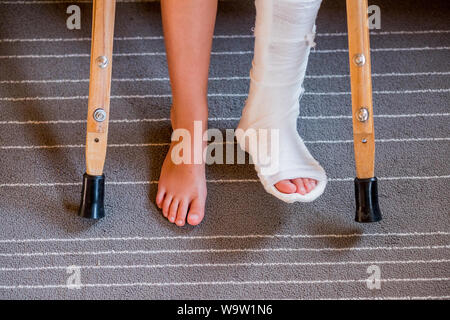 Gebrochenes Bein in Gips der unkenntlich kleines Kind. Junge Mädchen in der orthopädischen cast auf Krücken im Hause. Kind mit einem gebrochenen Bein auf Krücken, knöchelverletzung Stockfoto