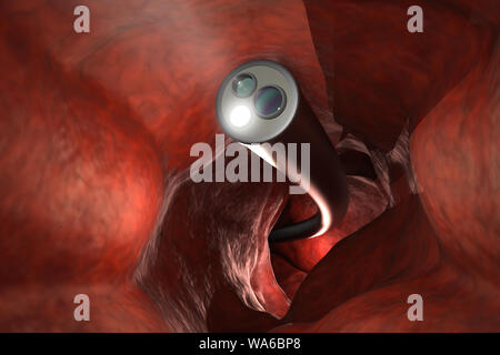 Colonoscopy Technologiekonzept mit 3D-rendering Endoskop innerhalb des Darmes Stockfoto