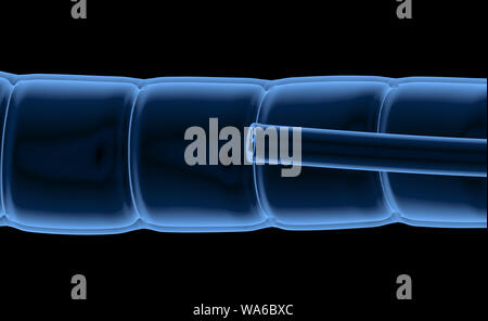 Colonoscopy Technologiekonzept mit 3D-Rendering x-ray Endoskop innerhalb des Darmes Stockfoto