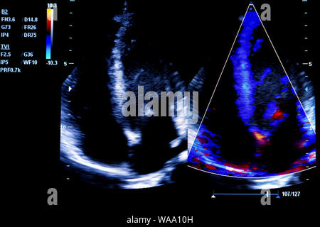 Bunte Bild der modernen Ultraschall überwachen. Ultrasonographie Maschine. High-tech-Medizin und medizinische Geräte. Die Ultraschalldiagnostik in mir verwendet Stockfoto