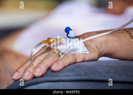 Nahaufnahme der leitenden Hand mit venösen Katheter. Nahaufnahme der Hand des alten Patienten mit intravenösen Katheter für die Einspritzung plug in der Hand Stockfoto