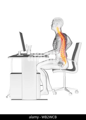 Büroangestellter mit Rückenschmerzen, konzeptionelle Darstellung. Stockfoto