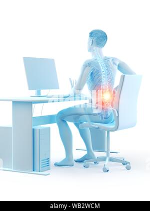 Büroangestellter mit Rückenschmerzen, konzeptionelle Darstellung. Stockfoto