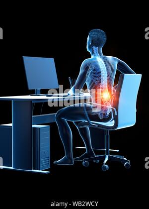 Büroangestellter mit Rückenschmerzen, konzeptionelle Darstellung. Stockfoto