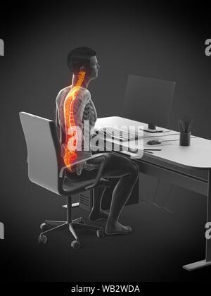 Büroangestellter mit Rückenschmerzen, konzeptionelle Darstellung. Stockfoto