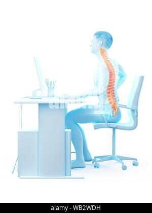 Büroangestellter mit Rückenschmerzen, konzeptionelle Darstellung. Stockfoto
