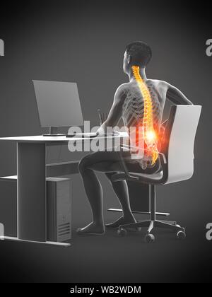 Büroangestellter mit Rückenschmerzen, konzeptionelle Darstellung. Stockfoto