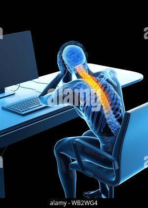Büroangestellter mit Rückenschmerzen, konzeptionelle Darstellung. Stockfoto