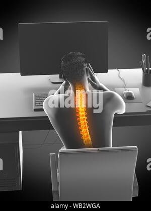 Büroangestellter mit Rückenschmerzen, konzeptionelle Darstellung. Stockfoto