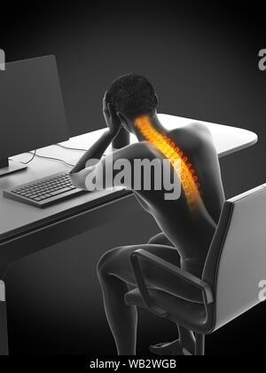 Büroangestellter mit Rückenschmerzen, konzeptionelle Darstellung. Stockfoto