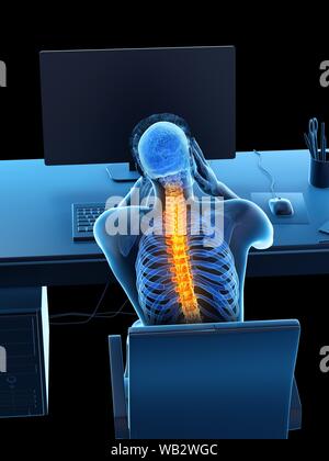 Büroangestellter mit Rückenschmerzen, konzeptionelle Darstellung. Stockfoto