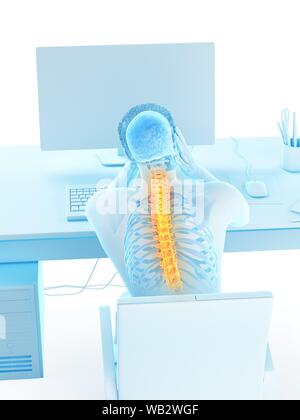 Büroangestellter mit Rückenschmerzen, konzeptionelle Darstellung. Stockfoto