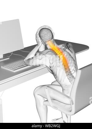 Büroangestellter mit Rückenschmerzen, konzeptionelle Darstellung. Stockfoto