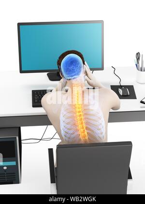 Büroangestellter mit Rückenschmerzen, konzeptionelle Darstellung. Stockfoto