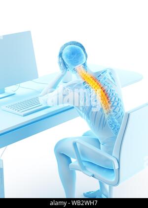 Büroangestellter mit Rückenschmerzen, konzeptionelle Darstellung. Stockfoto