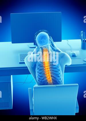 Büroangestellter mit Rückenschmerzen, konzeptionelle Darstellung. Stockfoto