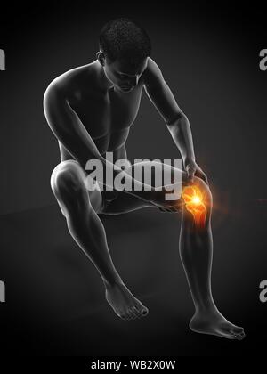 Knieschmerzen, konzeptionelle Darstellung. Stockfoto