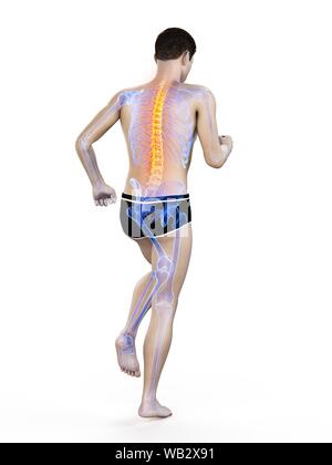 Rückenschmerzen, konzeptionelle Darstellung. Stockfoto