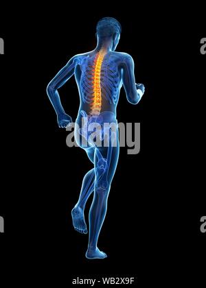 Rückenschmerzen, konzeptionelle Darstellung. Stockfoto